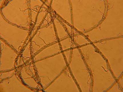 Microscopic image showing fibrillation on lyocell fiber